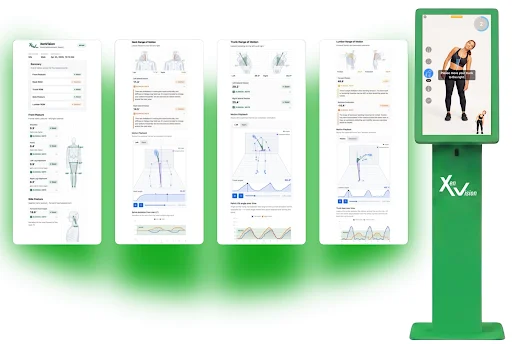 How Xenco Medical Is Using AI to See Human Movement Differently