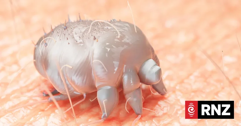 Doctors issue warning to treat scabies more seriously