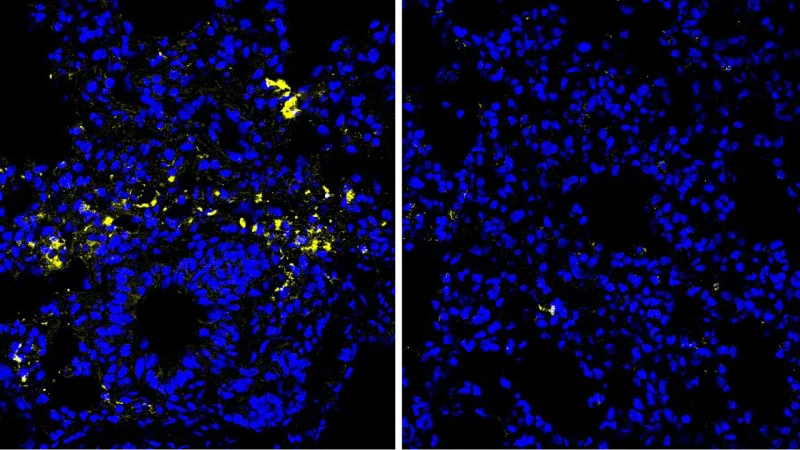 How one amino acid might help fight colon cancer and infections