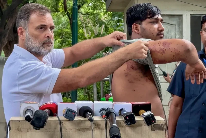 'Who approved pellet guns?' Rahul writes to Shah over 'barbaric' assault on students