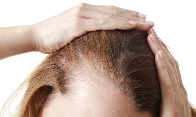 Some weight loss jabs are more likely to make you bald than others, study finds - and it's worse for women