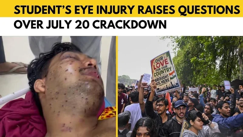 Watch: CJP Protests: 19-year-old NEET protester may lose vision after pellet injury