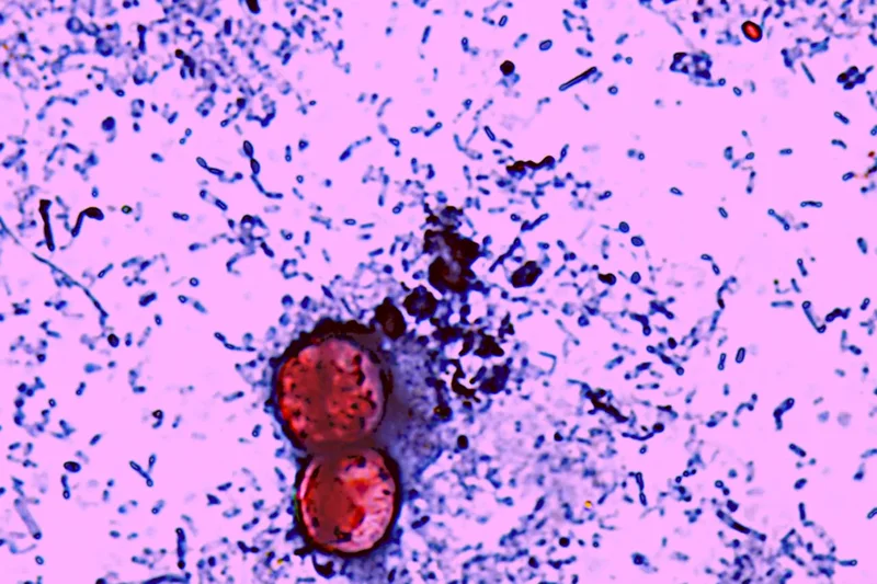 Things Are Getting Messier With the Explosive Diarrhea Parasite, as Officials Chase Down Multiple Outbreaks