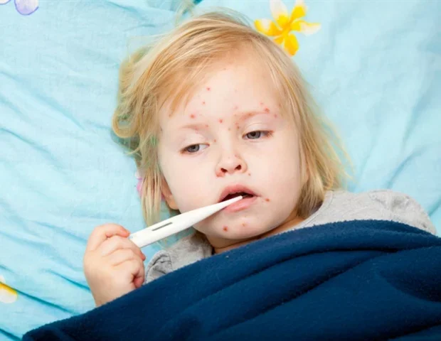 Oral drug candidate blocks transmission of measles-like disease in ferrets