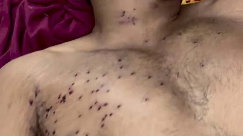 CRPF ‘verifying’ reports of pellet guns used against protesters in Delhi: official
