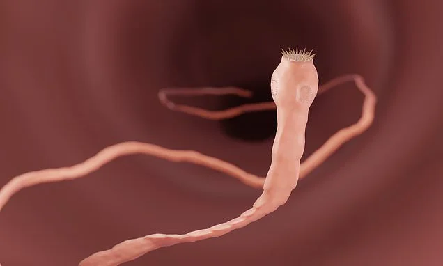 How to learn to love your tapeworm