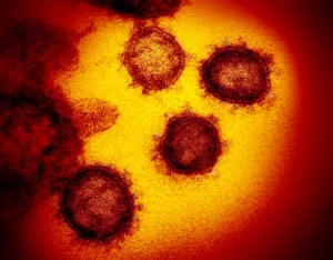 US curbs virus research Trump blamed for Covid pandemic