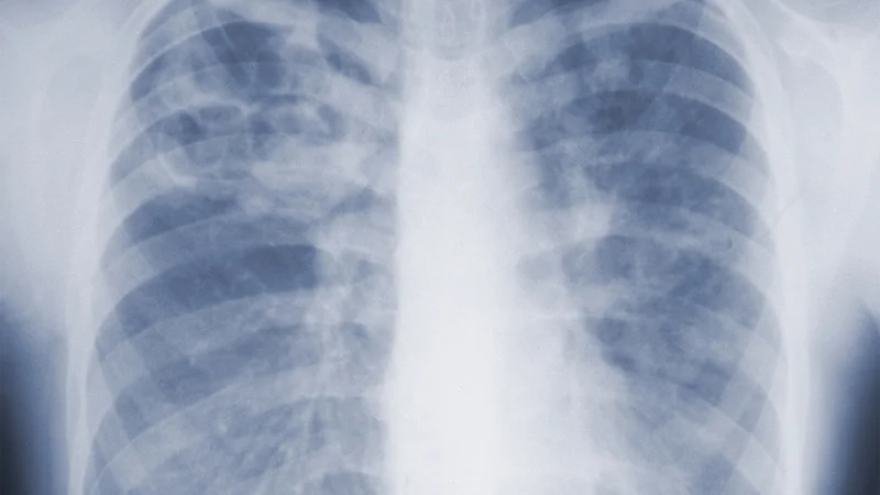 CDC Suggests Threat of Mold-Associated Illnesses May Be Underappreciated