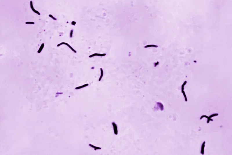 The bacterial infection linked to hundreds of deaths across England
