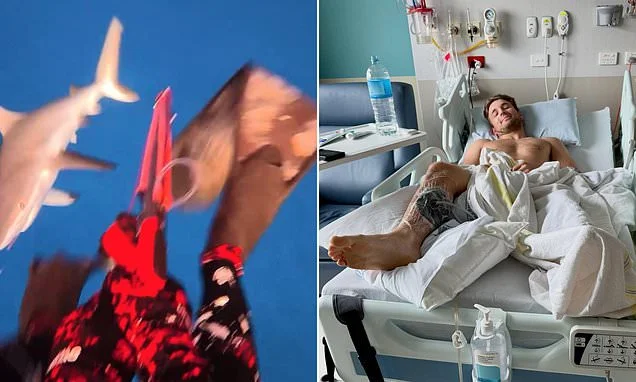 Moment terrified influencer is mauled and seriously injured by a shark in lightning attack while snorkelling in Fiji
