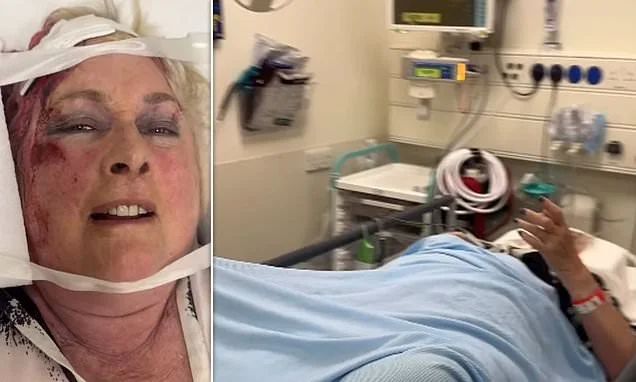 Binky Felstead's mum Jane, 74, is rushed to hospital after horror fall as she is left covered in bruises and blood
