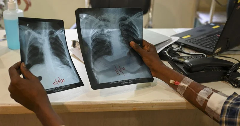 Interview: What Lakshadweep can teach the rest of India about eliminating TB