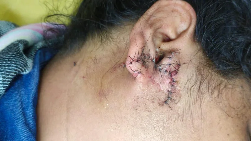 Gurugram woman says she was shot at during July 20 protest
