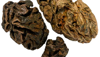 Archaeologists Have Found Thousands of Intact Ancient Human Brains. Scientists Say They've Figured Out Why the Organs Don't Always Rot