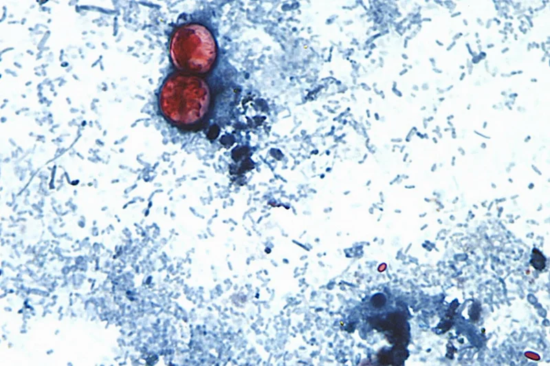 Michigan reports first 2 US deaths related to diarrhea-causing parasite
