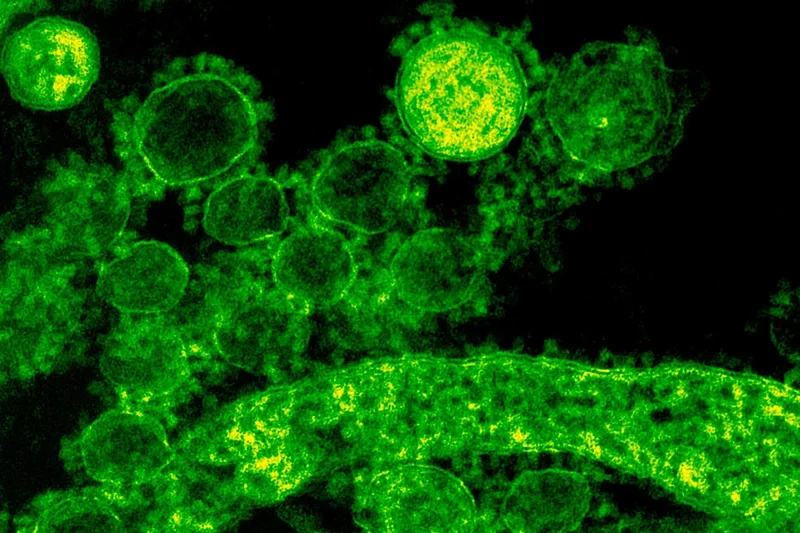 Severe COVID-19 reactivates dormant viruses and may leave a lasting viral signature