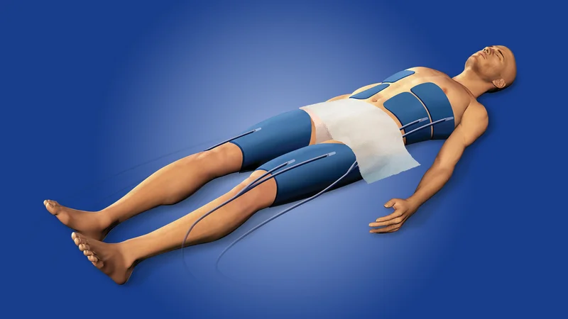 Longer Therapeutic Cooling Comes Up Short After Cardiac Arrest