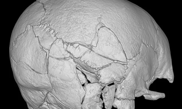 The Scottish soldier whose skull was crushed by a trebuchet: Skeleton found at Stirling castle is first confirmed victim of trebuchet attack