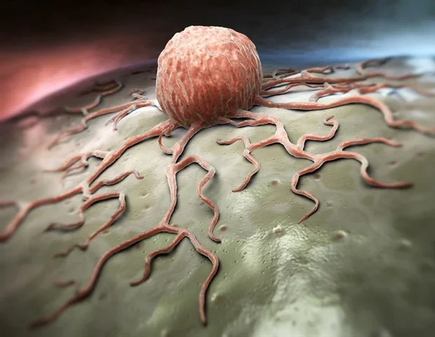 Study identifies a novel direct drug target for head and neck squamous cell carcinoma