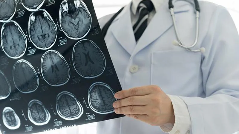 What does the new research on Vitamin B12-based therapy for brain cancer reveal?