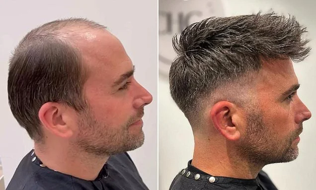 I started going bald at 23. It shattered my confidence and I began comfort eating. None of the 'solutions' helped - until I discovered this method that gave me my hair back... and I even lost 4 stone. Anyone can do it