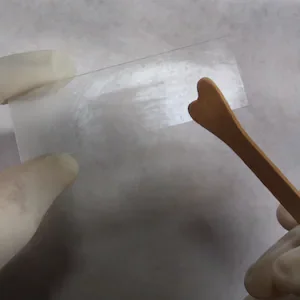 Cervical screening: Almost one million notifications not sent, review finds