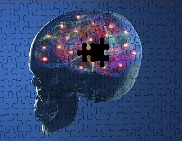 New protein blueprint opens door for targeted Parkinson's disease therapies