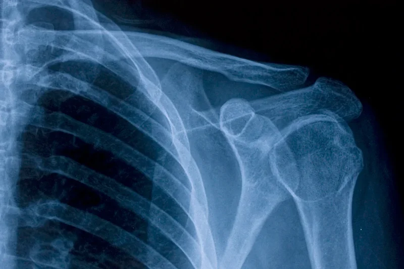 How sleep and your internal body clock help keep your bones strong