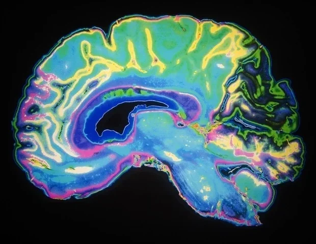 Researchers uncover hierarchical sensory processing system in the zebrafish brain
