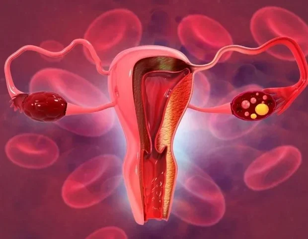 Computational pipeline uncovers subtype specific targets for cervical cancer