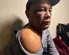 Man suffered brain injury and severe bruising after ICE arrest in Virginia, records show