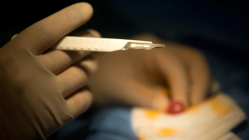 Circumcision and Autism: What a New Study Found