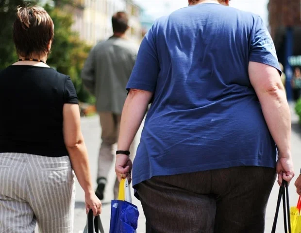 New review links obesity with accelerated biological aging mechanisms