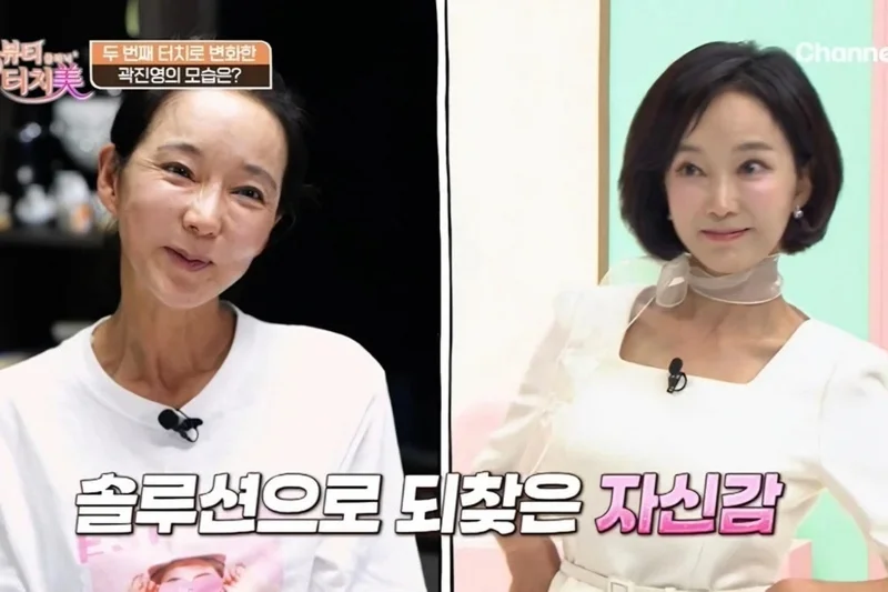 Actress says she wanted her old face back after plastic surgery complications