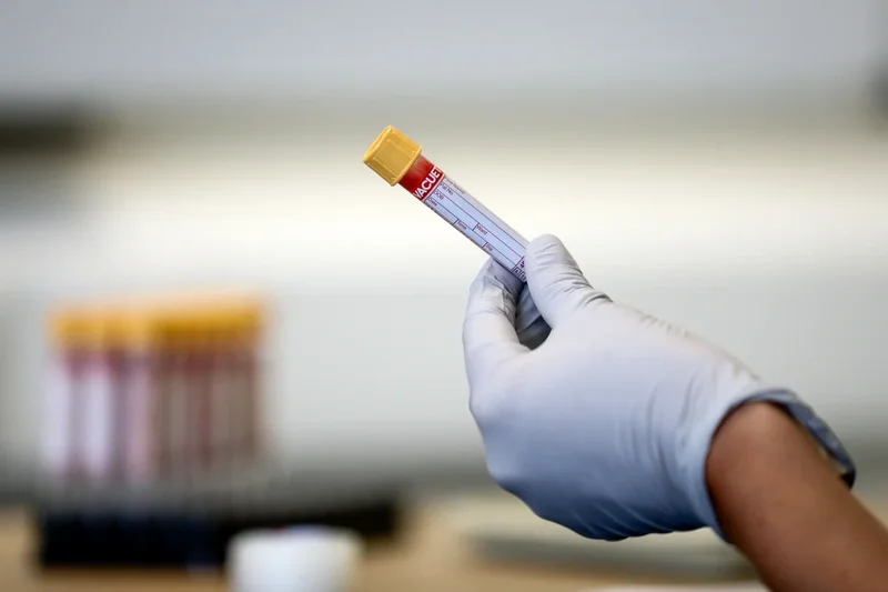 A new test could detect Alzheimer’s within minutes. Should I have one?