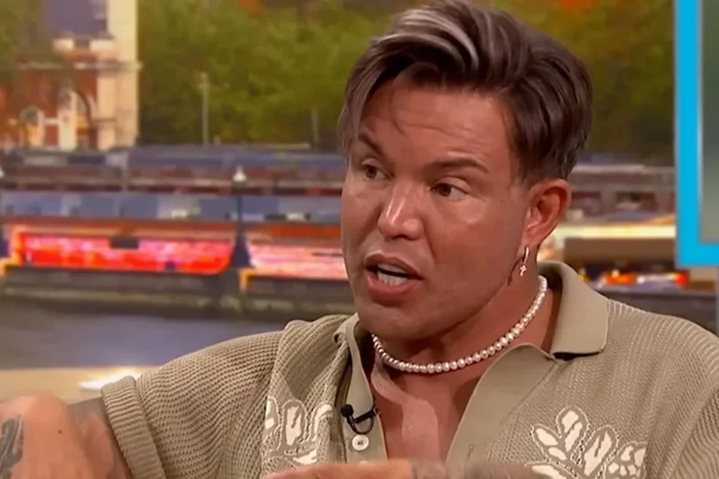 Bobby Norris welcomes comparisons to Katie Price as he opens up on number of plastic surgery procedures