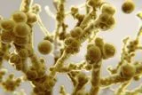 How a Deadly Superbug Tricks the Immune System to Survive in Hair Follicles