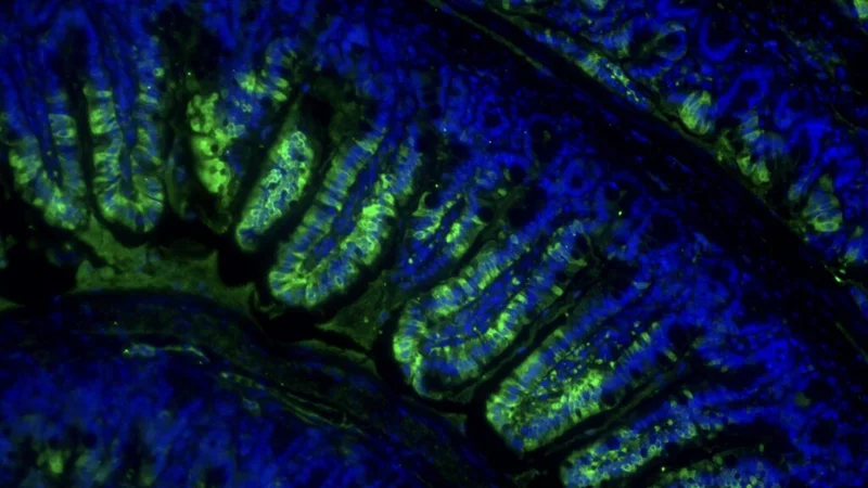 STAT+: A pill that mimics exercise? Early results on drug designed to maintain both weight loss and muscle mass