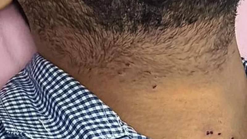 At least 10 people injured by pellets on July 20, shows RTI response