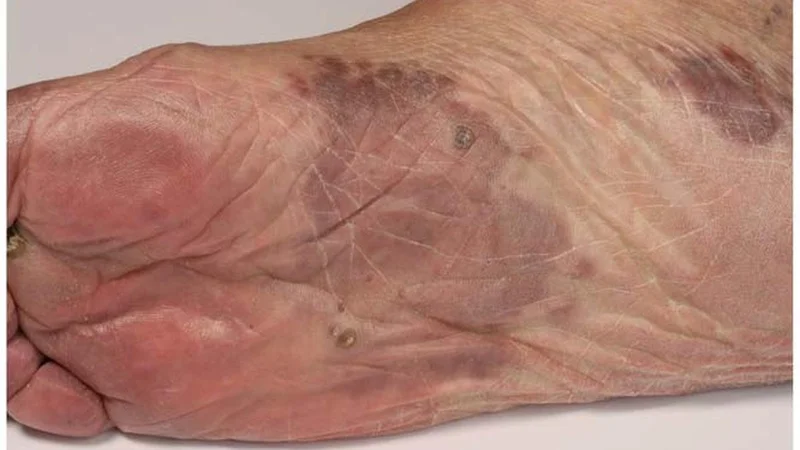 Unexplained lumps and what you should do about them