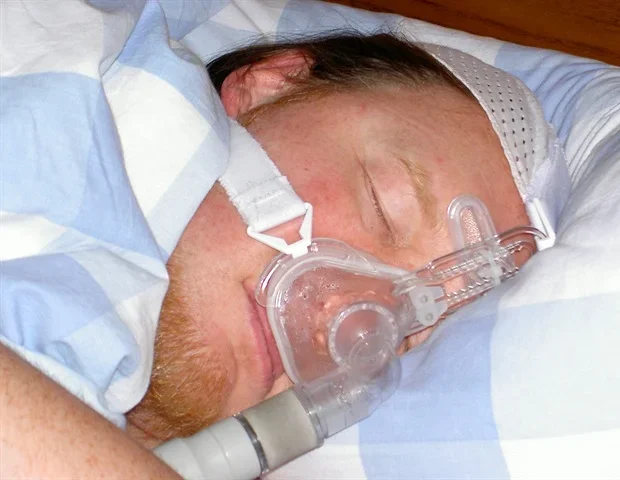 Hypothyroidism linked to higher risk of obstructive sleep apnea