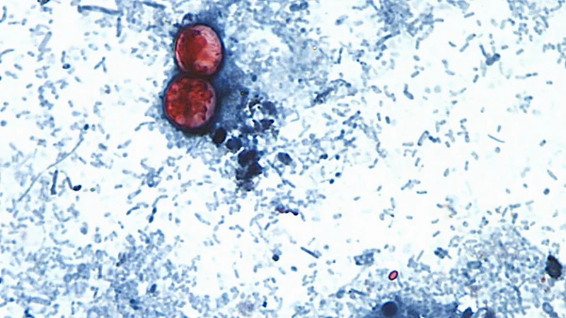 Michigan Reports First Two U.S. Deaths Related to Diarrhea-Causing Parasite