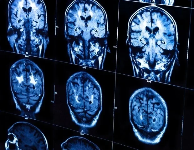 Res-SwinFusion improves anatomical landmark localization with hybrid AI approach