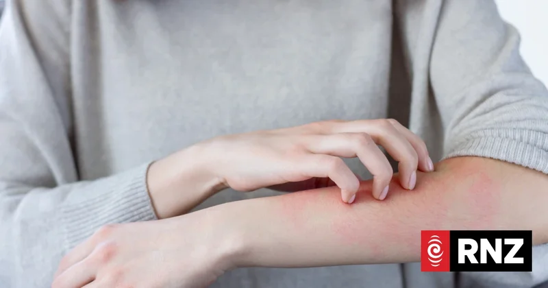 Hatching and scratching: What you need to know about scabies but were afraid to ask