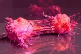 Viagra May Limit Cancer&rsquo;s Spread by Trapping Cholesterol Inside Cells