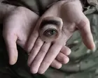 Blinded by War: documenting the aftermath of injury in Ukraine – photo essay