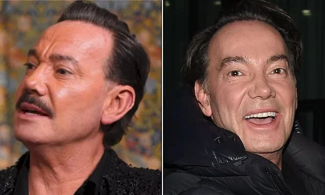 Strictly's Craig Revel Horwood says he was stabbed and slashed with a razor blade during mugging in Madrid before being strip-searched over drug smuggling concerns
